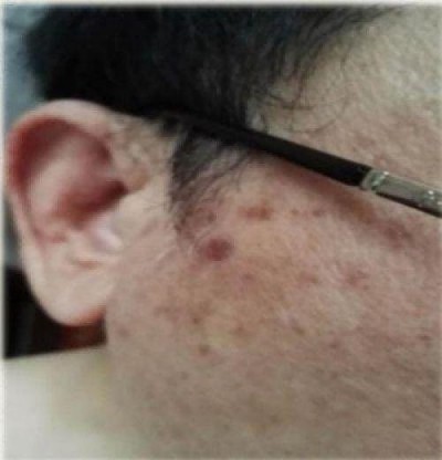 量子氢氧健康第一人长寿哥(廖永贵院士) 让科学量氢氧品牌走向世界!